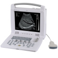 MT Medical China Digital Portable Veterinary Ultrasound Price